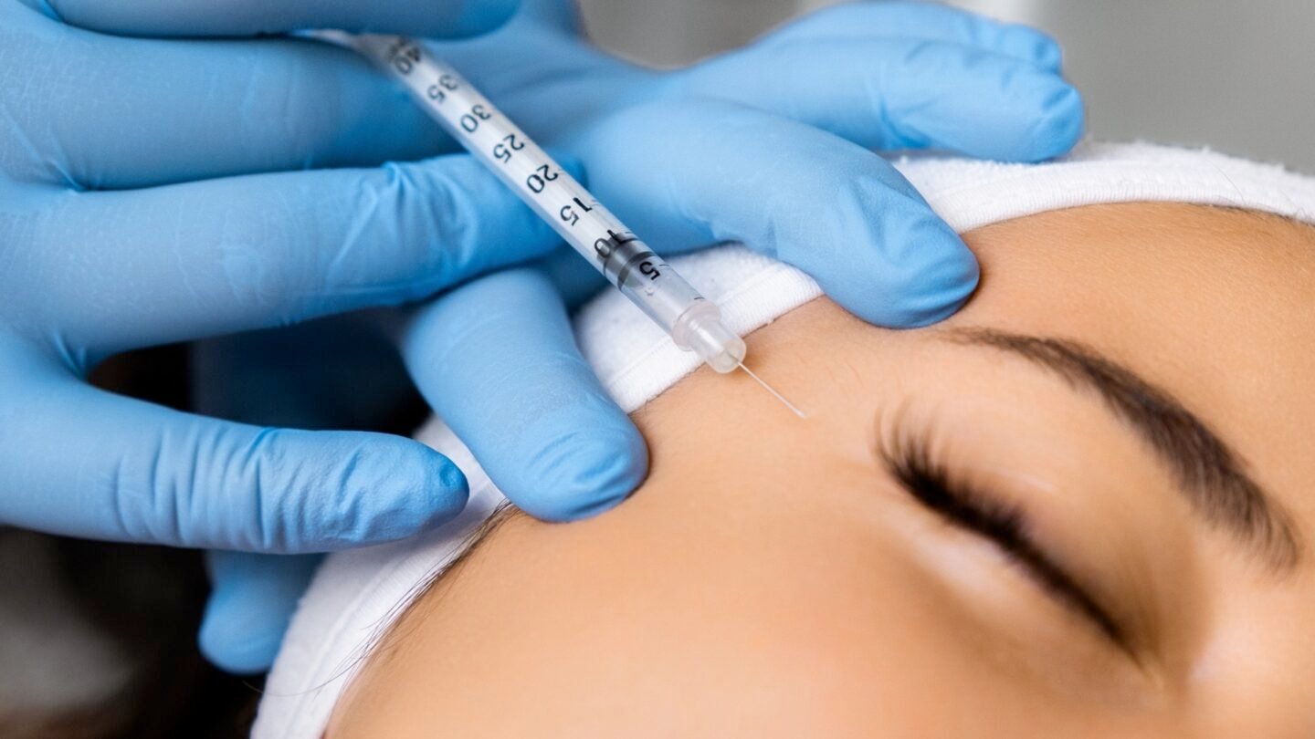 Botox Periocular