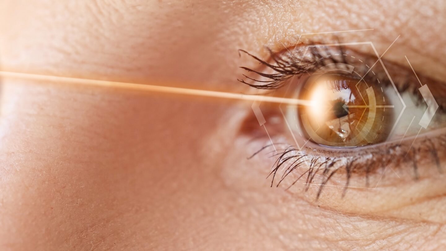 YAG Laser