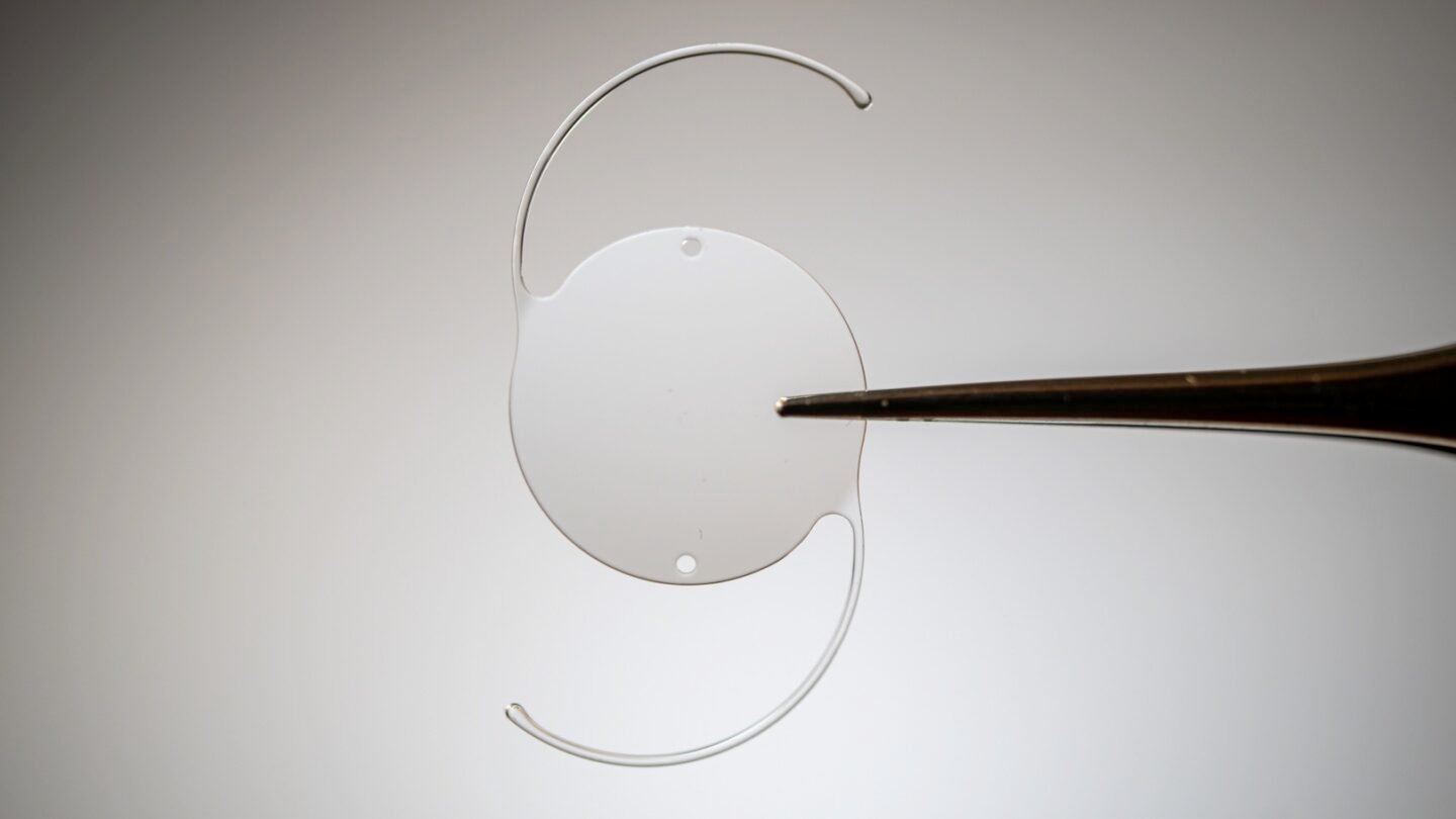 Cirurgia de Catarata com Implante de Lente Intraocular